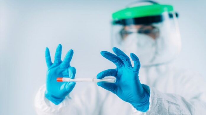 test-coronavirus