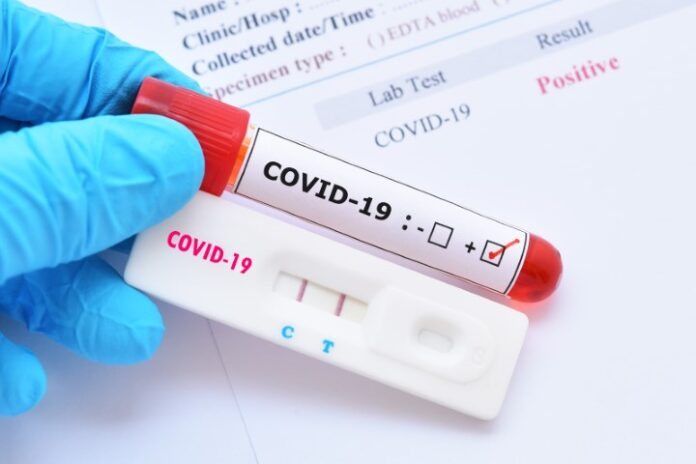 Test-Covid-19
