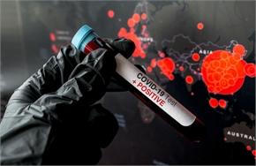 coronavirus