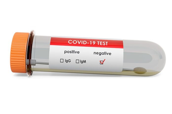 test negativ covid